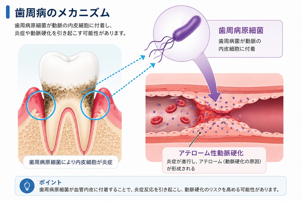 歯原生菌血症の模式図