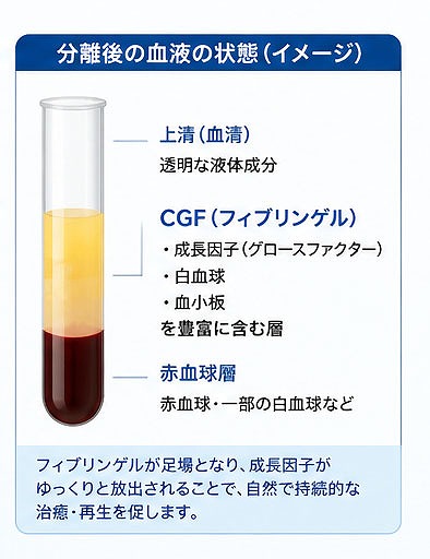 CGF