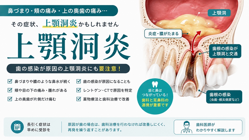 上顎洞炎とは？