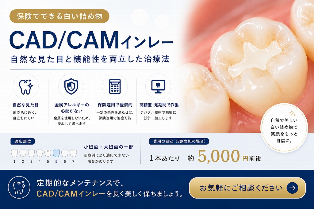 CAD/CAMインレーとは？｜保険適用の白い詰め物のメリット・デメリット