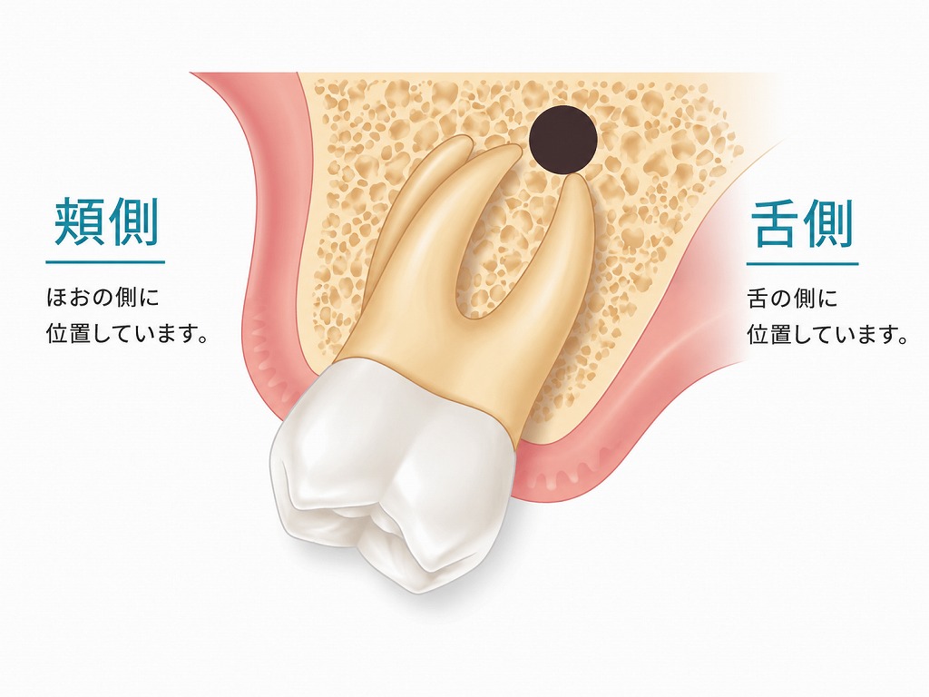上顎大臼歯で手術不可能な症例