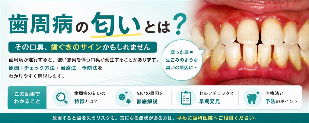 歯周病の匂いとは？