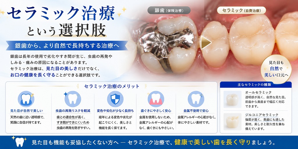 セラミック治療という選択肢