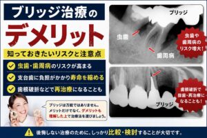 歯ブリッジは本当におすすめ？