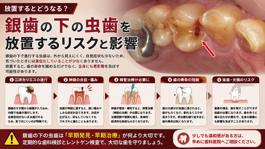 放置するとどうなる？
