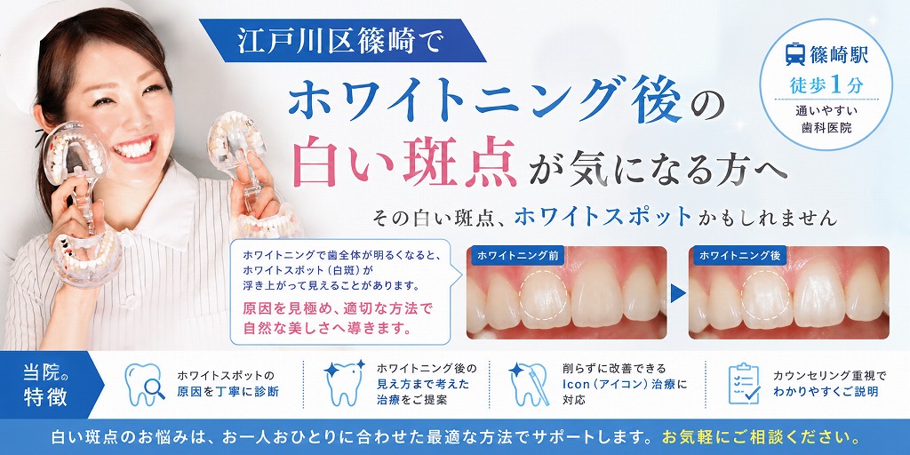 江戸川区篠崎でホワイトニング後の白い斑点が気になる方へ