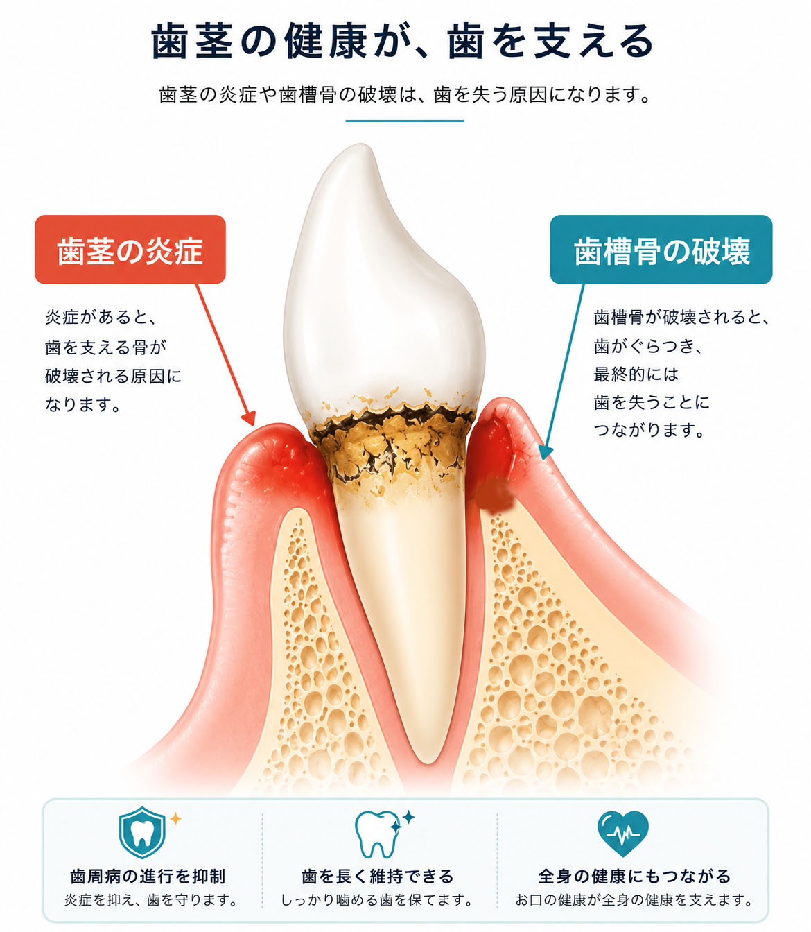 歯周病