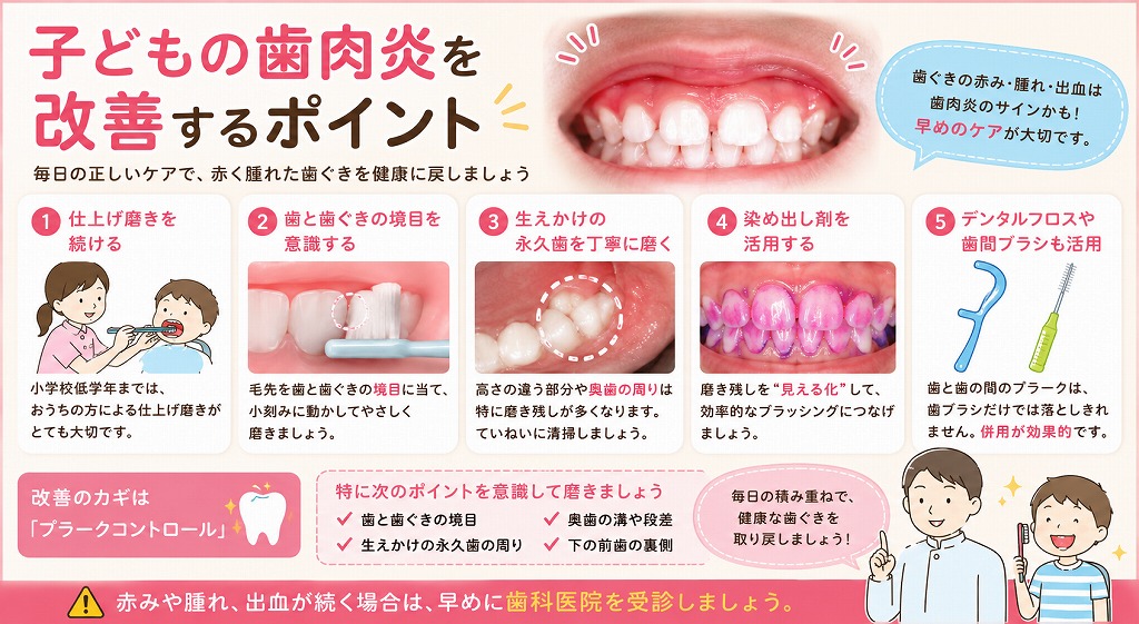 子どもの歯肉炎を改善するポイント