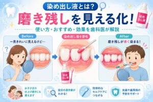 染め出し液とは？歯磨きの磨き残しを見える化｜使い方・おすすめ・効果