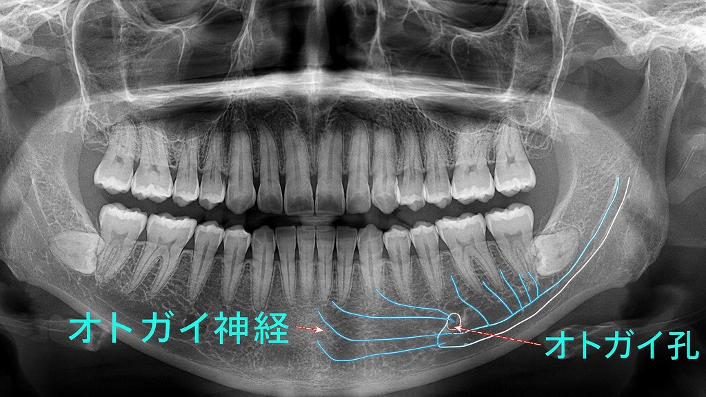 オトガイ神経の位置と役割