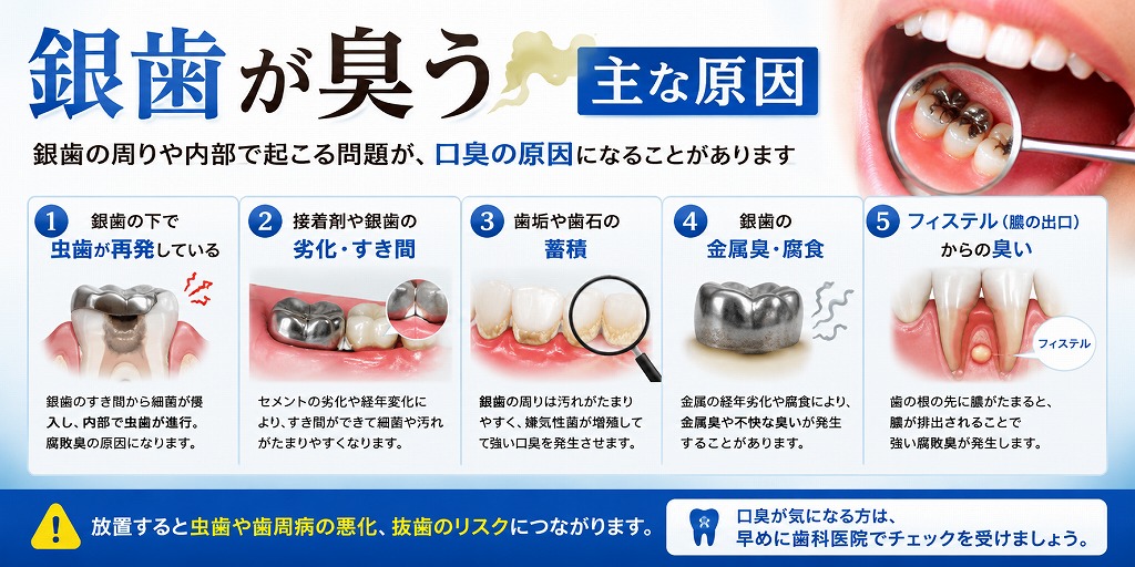 銀歯が臭う主な原因