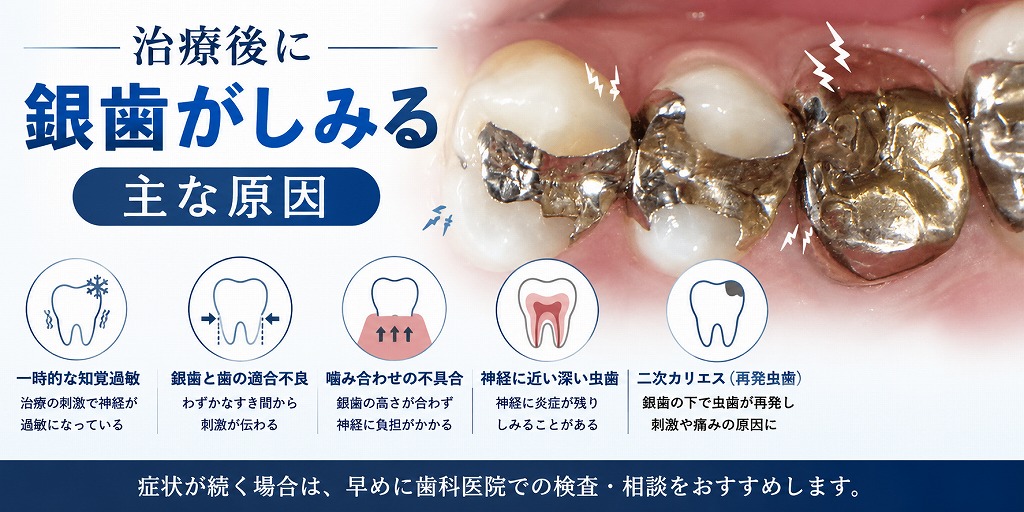 治療後に銀歯がしみる主な原因