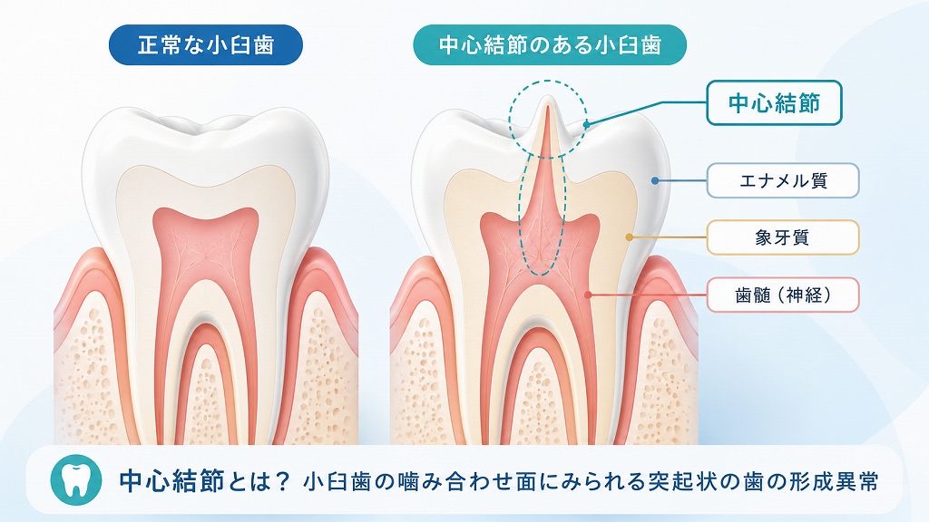 中心結節とは