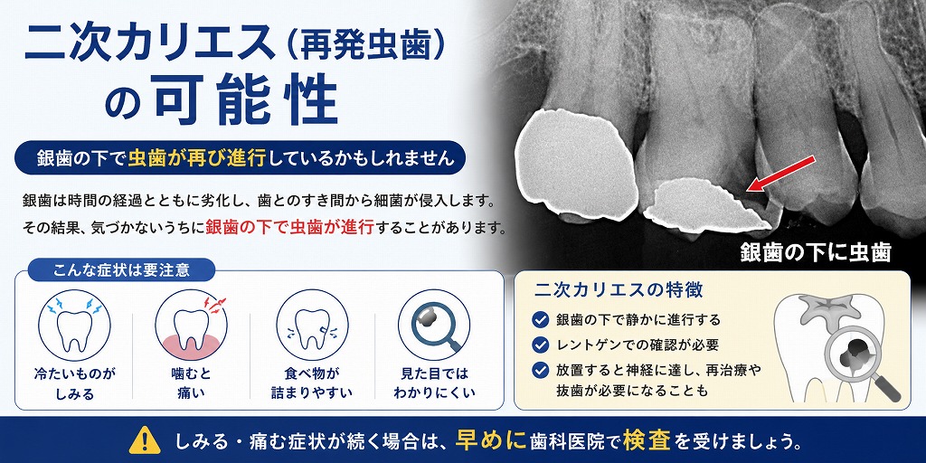 二次カリエス（再発虫歯）の可能性