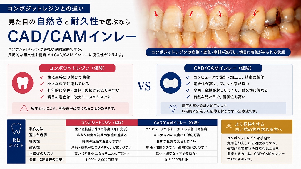 コンポジットレジンの弱点：変色・摩耗が進行した症例