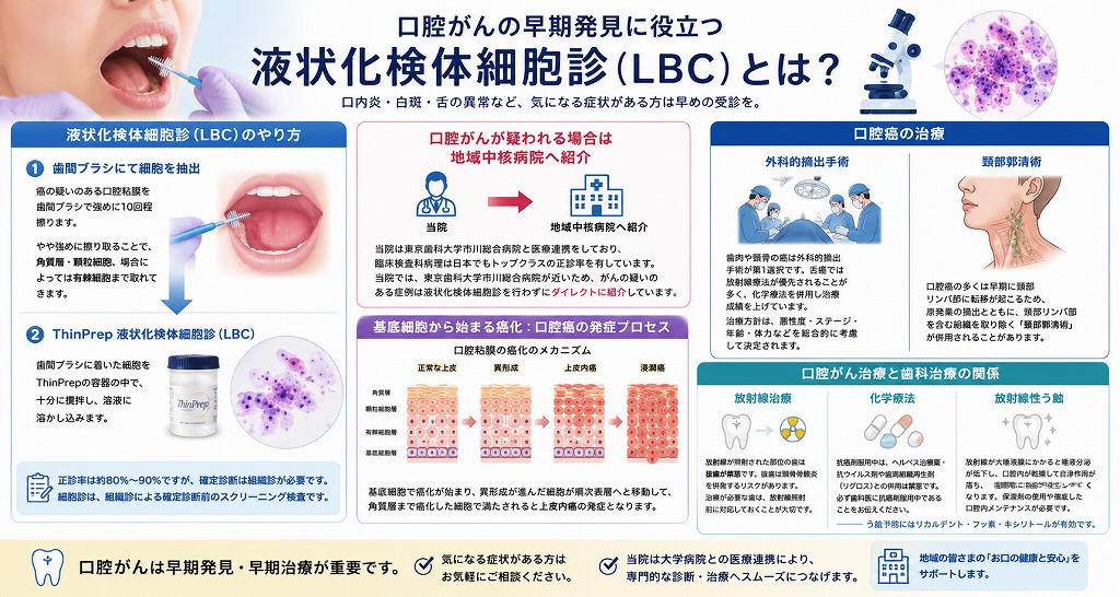 液状化検体細胞診（LBC）