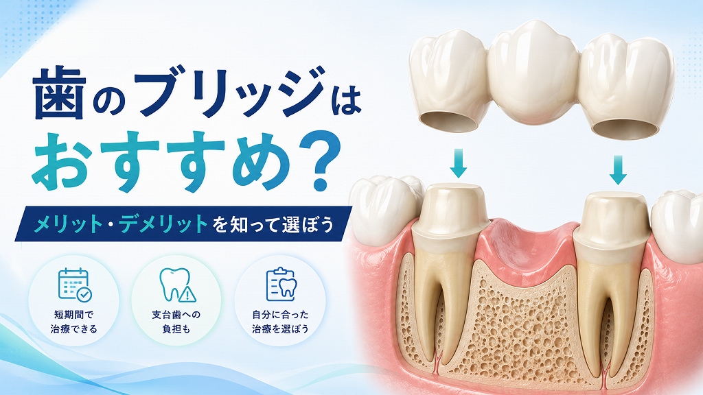 歯のブリッジは本当におすすめ？