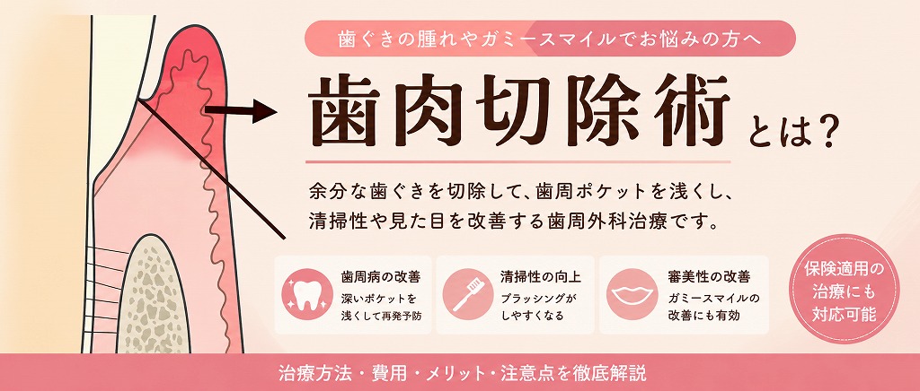 歯肉切除術とは