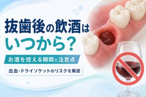 抜歯後の飲酒はいつから?|お酒を控える期間とドライソケット・出血のリスク