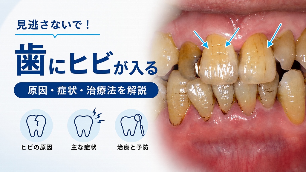 歯にヒビが入る