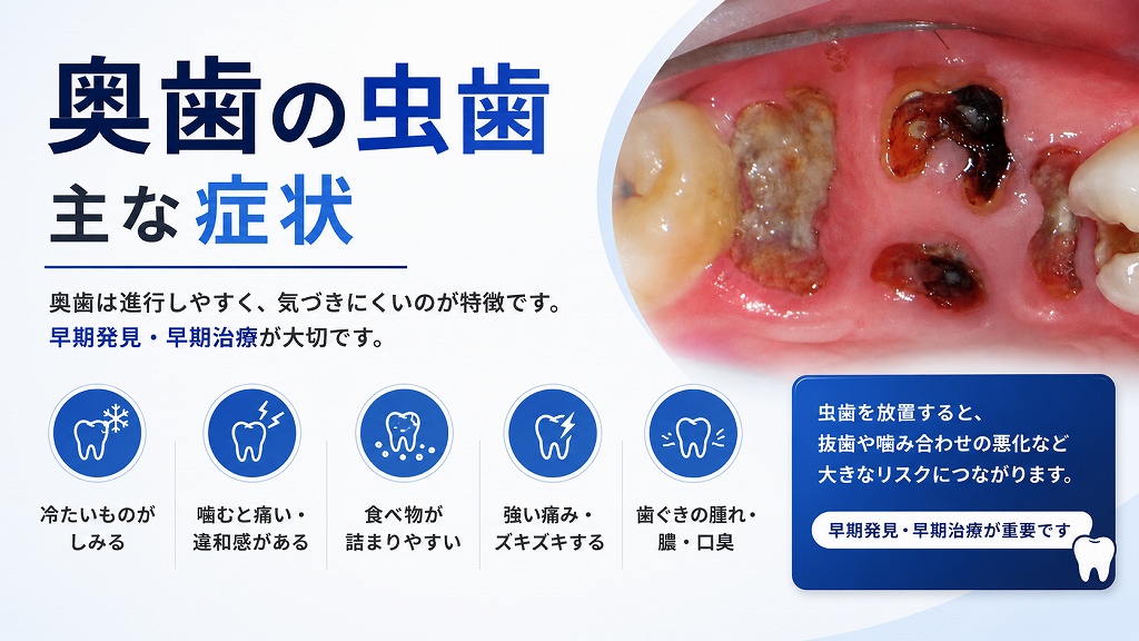 奥歯の虫歯の主な症状