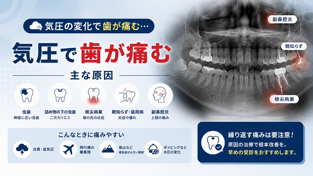 気圧で歯が痛む主な原因