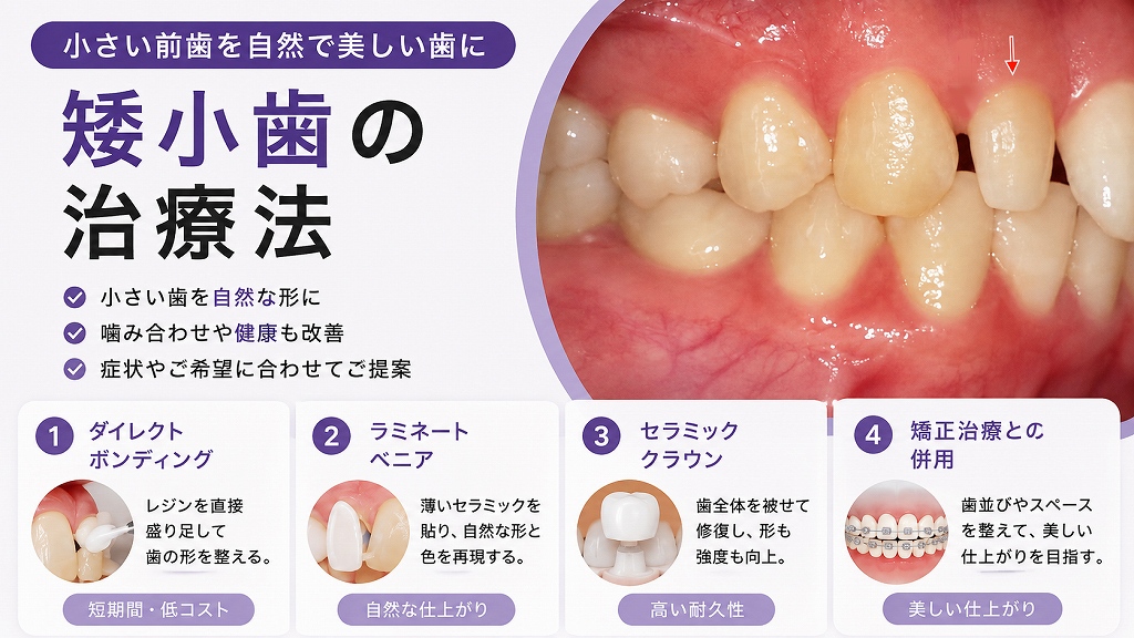 矮小歯の治療法