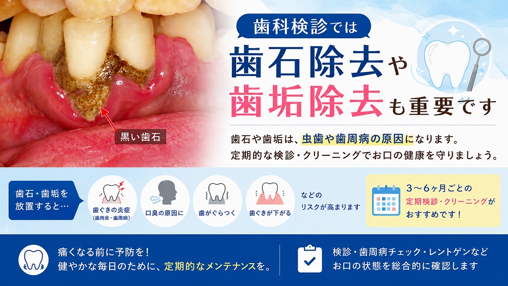 歯科検診では歯石除去や歯垢除去も重要です