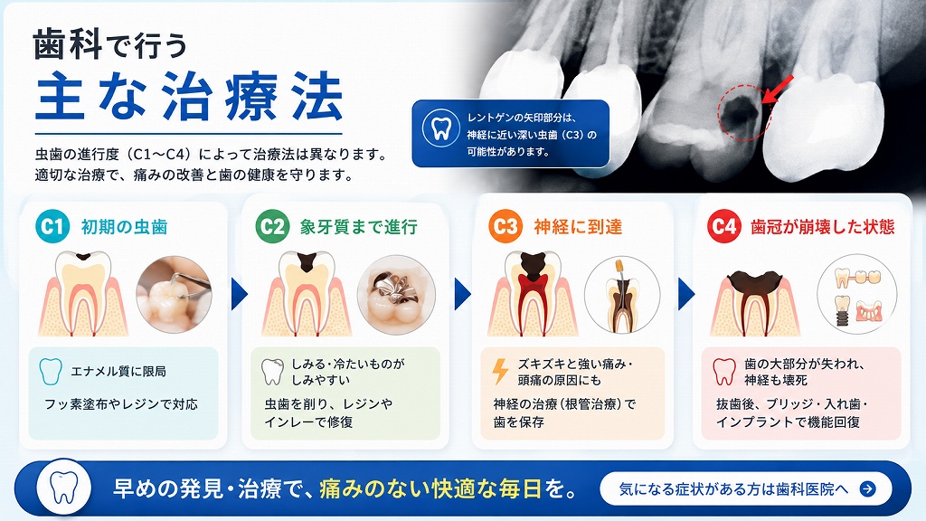 歯科で行う主な治療法