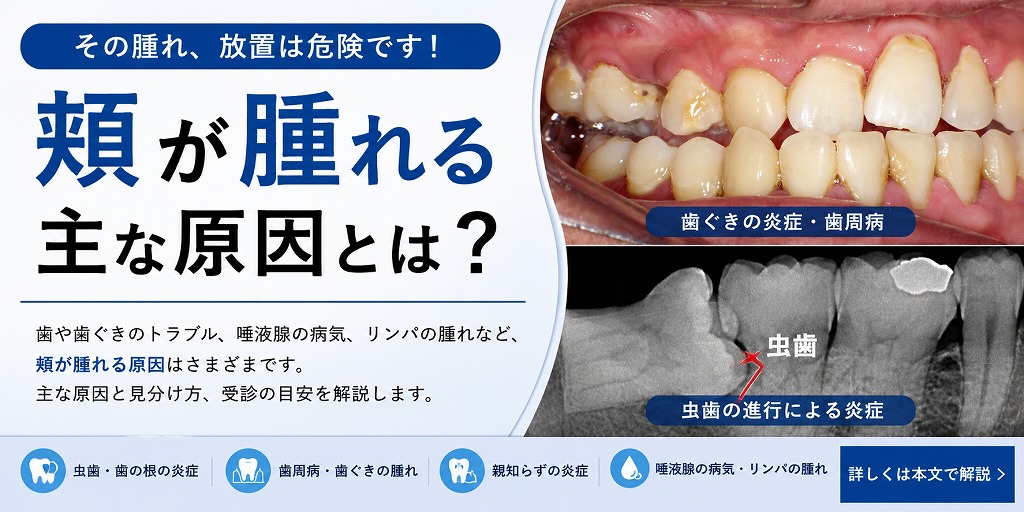頬が腫れる主な原因