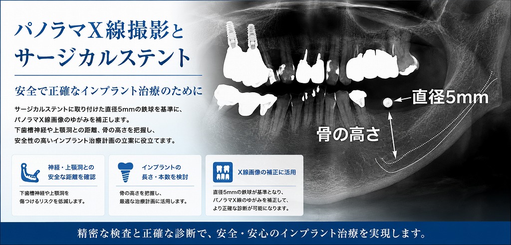 パノラマX線撮影とサージカルステント
