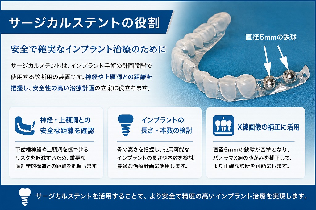 インプラント手術の安全性を高める！サージカルステントとサージカル