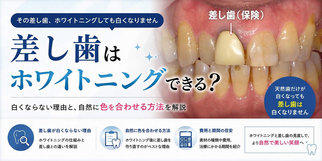 差し歯はホワイトニングで白くなる？