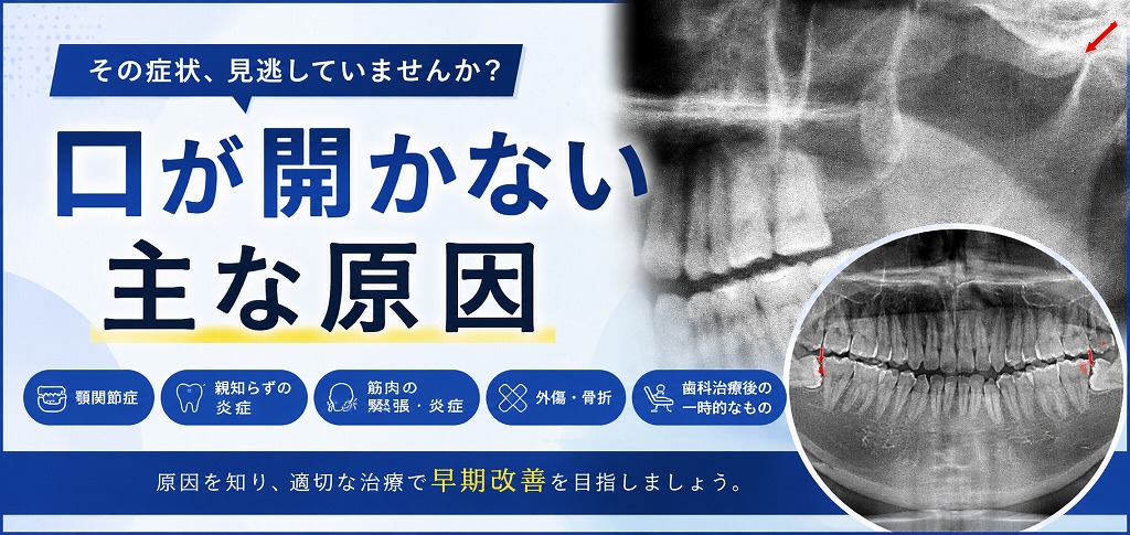 口が開かない主な原因