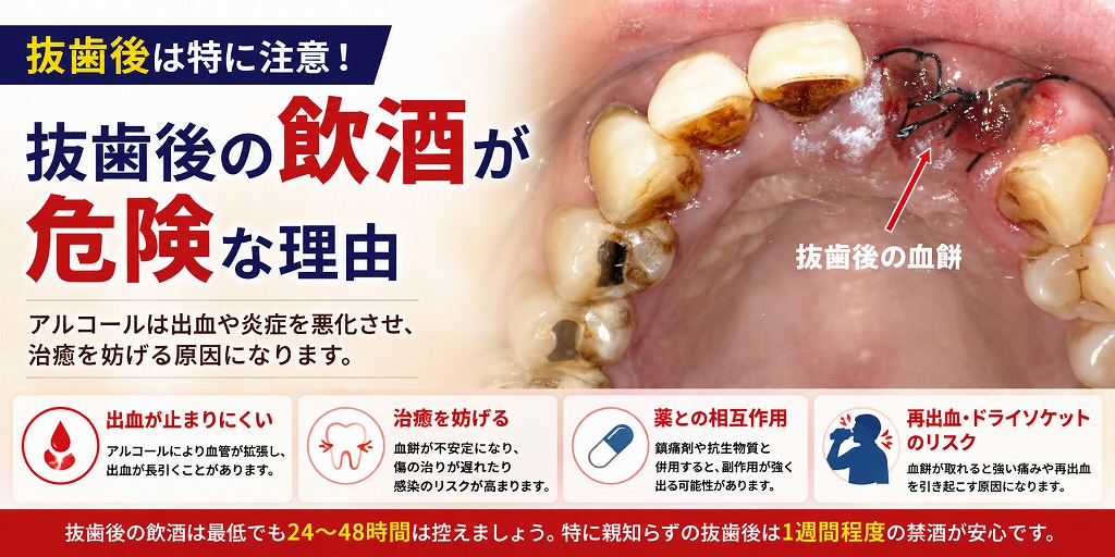 抜歯後の飲酒が危険な理由
