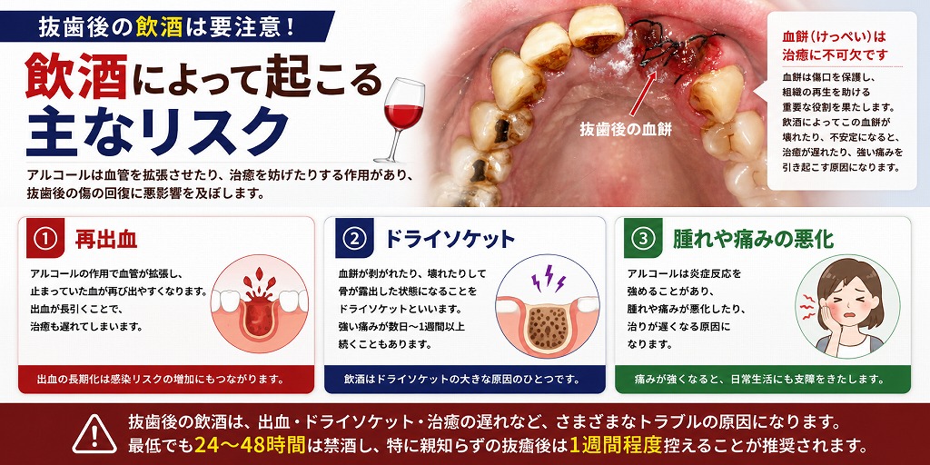 飲酒によって起こる主なリスク