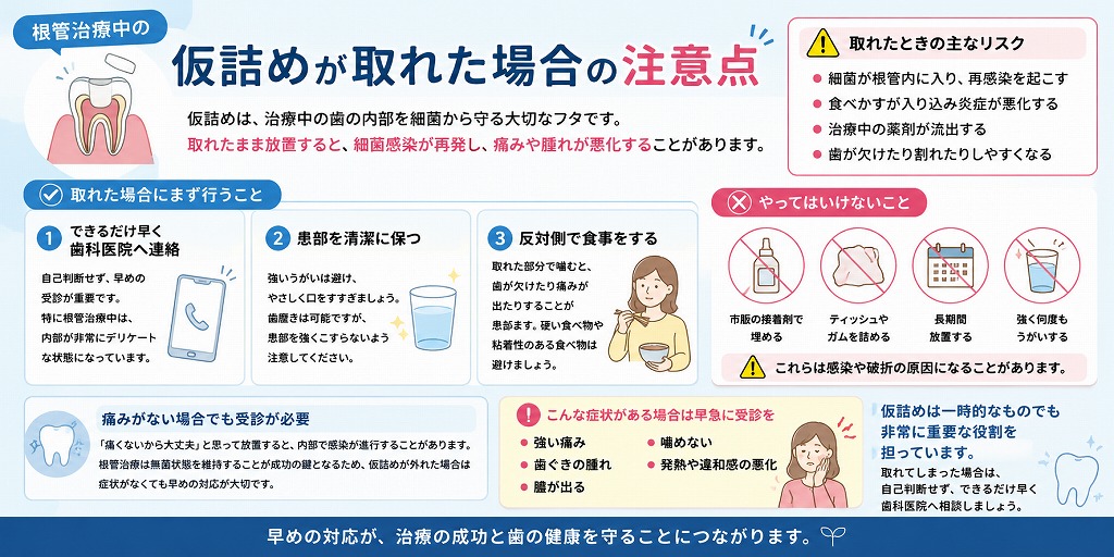 根管治療中の仮詰めが取れた場合の注意点