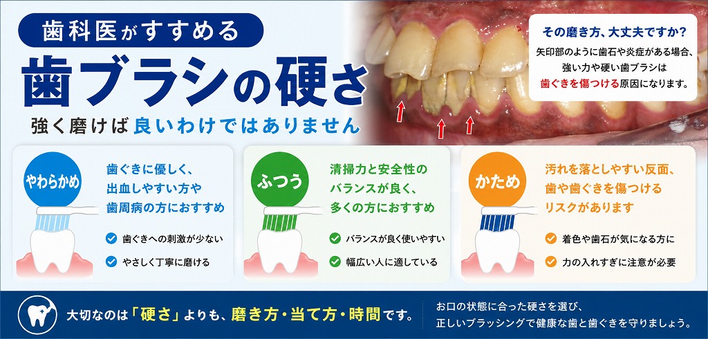 歯ブラシの硬さとは?