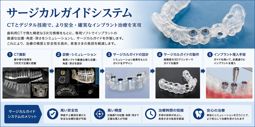 サージカルガイドシステム
