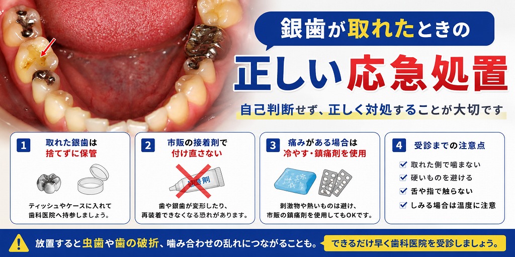 銀歯が取れたときの正しい応急処置