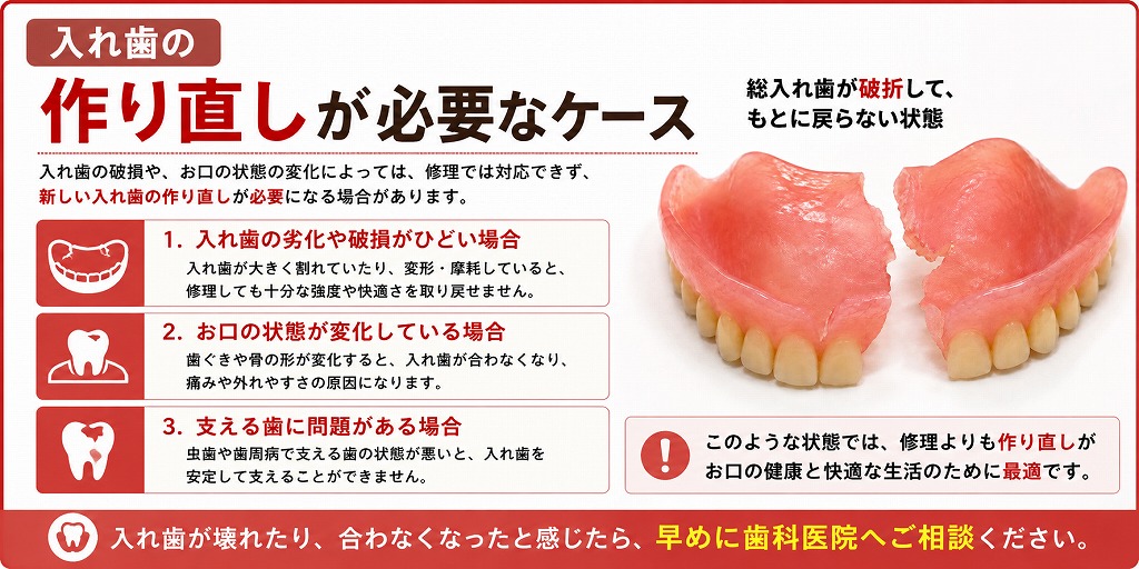 入れ歯の作り直しが必要なケース