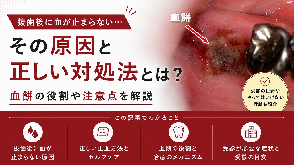 抜歯後に血が止まらないのはなぜ？