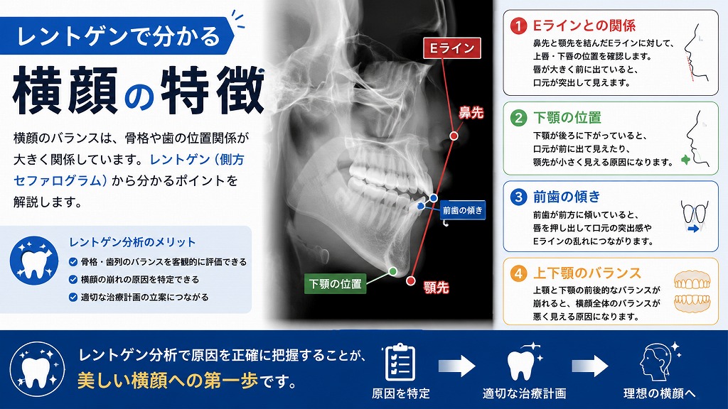 レントゲンで分かる横顔の特徴