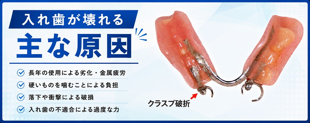 入れ歯が壊れる主な原因