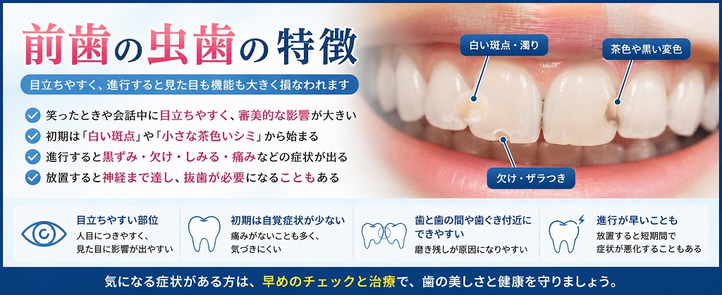 前歯の虫歯の特徴
