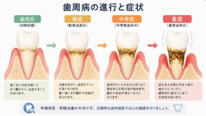 歯周病