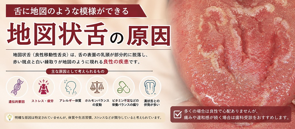 地図状舌の原因