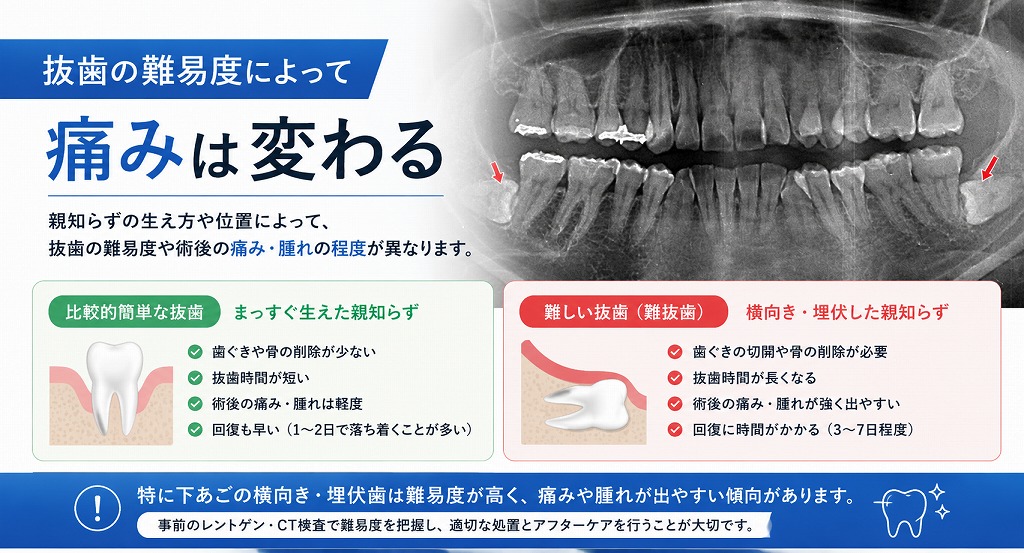 抜歯の難易度によって痛みは変わる