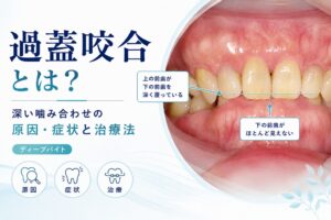 過蓋咬合とは？原因・症状と放置するリスク、子ども・大人の治療法
