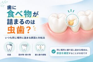 歯に食べ物が詰まるのは虫歯？いつも同じ場所に詰まる原因と対処法